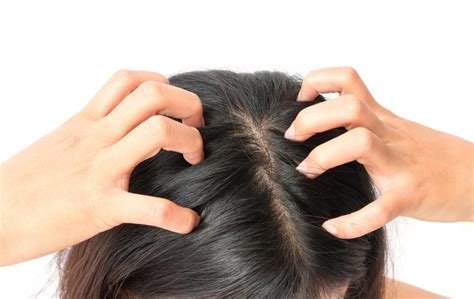 Oily Scalps Do They Cause Hair Loss 2022 Hair Loss Geeks