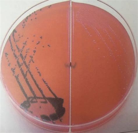 Xld Agar Composition Principle Results And Uses Microbe Online