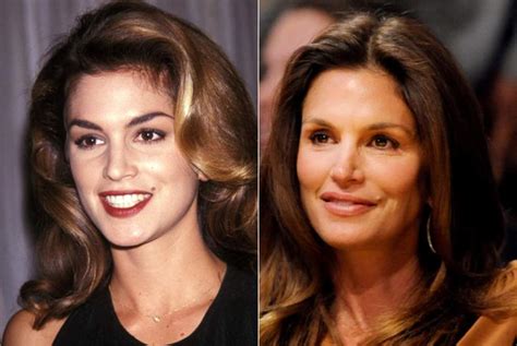 8 Gorgeous Stars Before And After Botox Her Beauty