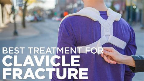 How To Treat A Broken Collarbone With A Clavicle Brace Youtube