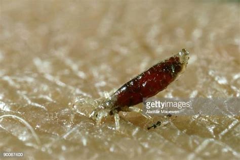 Human Body Lice Photos And Premium High Res Pictures Getty Images