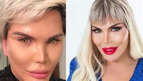 Ex Ken Humano Fará Cirurgia De Mudança De Sexo Sou Mulher Trans