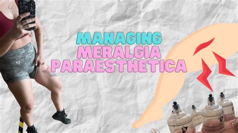 Managing My Meralgia Paresthetica Supplements Stretches And Physical