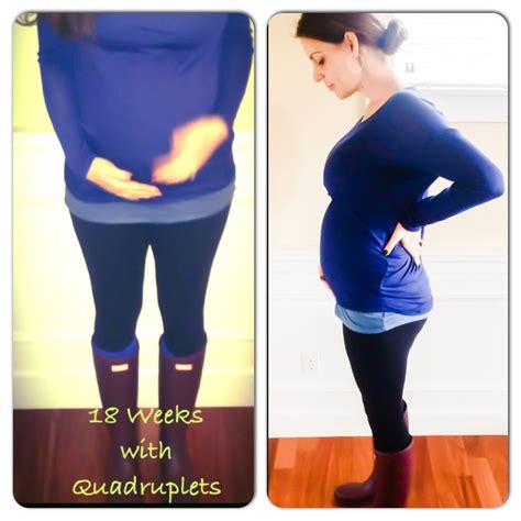 pin on my pregnancy with quadruplets