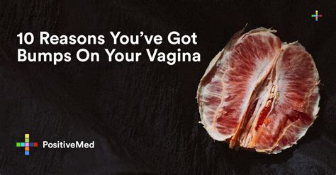 10 Reasons You Have Got Bumps On Your Vagina