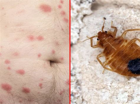 Bed Bugs In Sofa Only Baci Living Room
