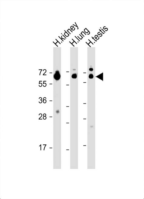 hhla2 antibody n term peptide affinity purified rabbit polyclonal antibody pab wb ihc p
