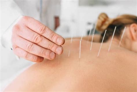 Acupuncture Acupressure And Tui Na Massage Newcastle Livingsocial
