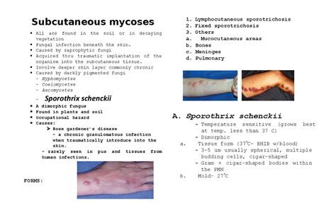 Lecture No 5 Subcutaneous Mycoses Subcutaneous Mycoses All Are Found