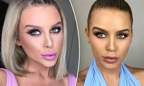 Κάνε κλικ για να παίξεις το δωρεάν παιχνίδι nose jobs! Has Skye Wheatley had a nose job? | Daily Mail Online