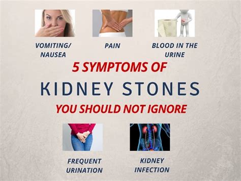 Important Signs And Symptoms Of Kidney Stones