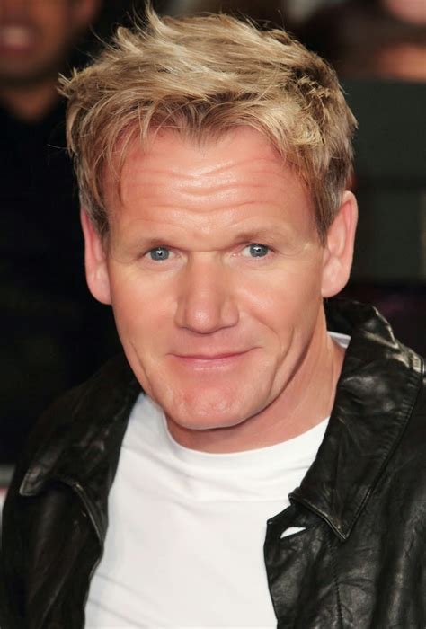 All celebrities in the video. Celebrity Hair Loss: Transplant Watch: Gordon Ramsey