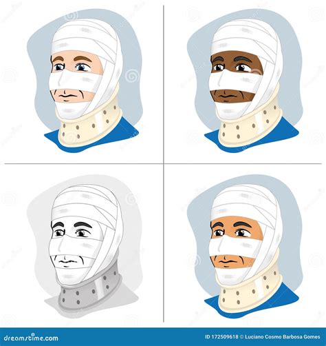 Illustration Of A Human Head With Bandages Using Cervical Collar To Immobilize The Neck Ethnic