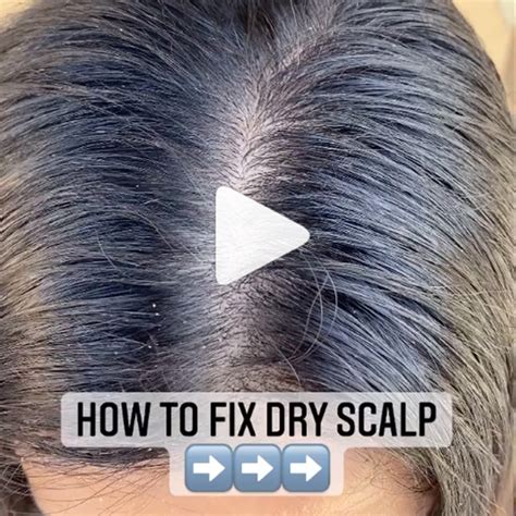 How To Fix A Dry Scalp With One Trick