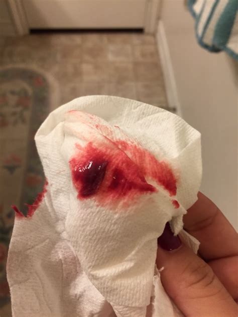 Bleeding could be considered normal until it does not soak a sanitary pad or a panty liner (2). Is ovulation spotting bright red ? Please help - Glow ...