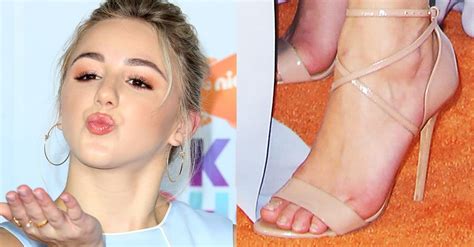 Chloe Lukasiaks Lazy Eye Is Caused By Silent Sinus Syndrome