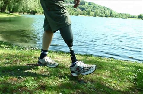 Walking On A Prosthetic Leg ‹ News Kenney Orthopedics Orthotics