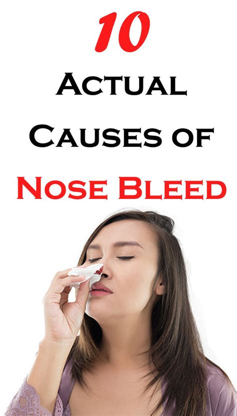 Nose Bleed Causes Treatment And More Ubicaciondepersonascdmxgobmx