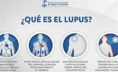 Video ¿qué Es El Lupus Cinco Datos Clave De Esta Enfermedad