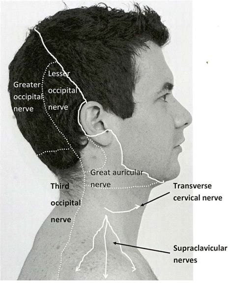 Occipital Nerve Areas Affected By Pain Neuralgia Chronic Pain