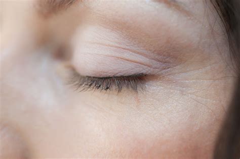 Remedios Caseros Para Tratar Las Arrugas Alrededor De Los Ojos