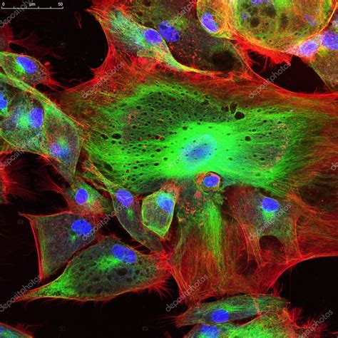 Confocal Microscopy Of Fibroblast Cells Stock Photo By ©vshivkova 119228280