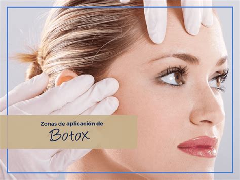 Zonas de Aplicación de Botox Beauty Discovery
