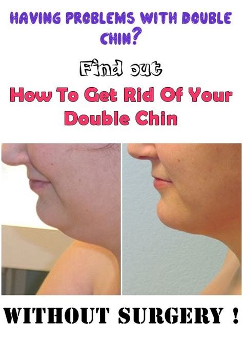 A lot of people around the world trying to get rid of a double chin tend to turn to invasive surgical procedures such as face lift and liposuction. How To Get Rid Of Your Double Chin | Double chin, Style ...