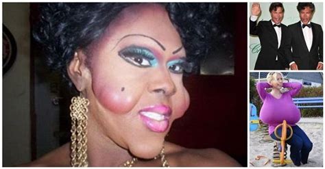 Plastic Surgery Disasters Alldaychic Plastic Surgery Gone Wrong