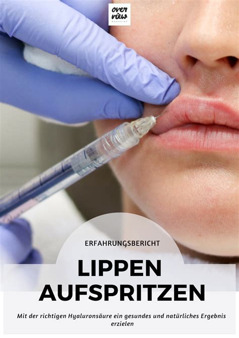 Lippen Aufspritzen Mit Der Richtigen Hyaluronsäure Für Ein Natürliches Ergebnis Lippen