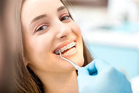 I have an overbite and 35. San Diego Braces Cost | University Dental | Braces for ...