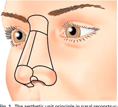 Figure From Transposition Flaps In Nasal Reconstruction Semantic