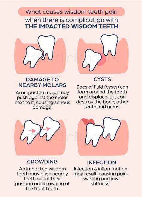 When it comes to dental procedures, tooth extraction — or having teeth pulled — is among commonly extracted teeth. Wisdom tooth extraction and surgery costs in Singapore ...