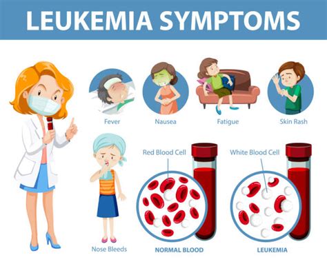 Chronic Leukaemia Illustrations Royalty Free Vector Graphics And Clip