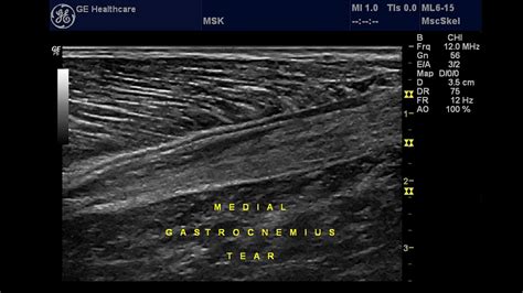 Musculoskeletal Msk Ge Healthcare