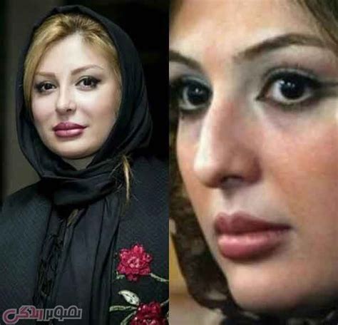 عکس قبل و بعد عمل بینی نیوشا ضیغمی Johannes Hijab Birthday Fashion Moda Birthdays Fashion