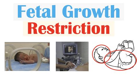 Fetal Growth Restriction Fgr Iugr Types Causes Torch Infections