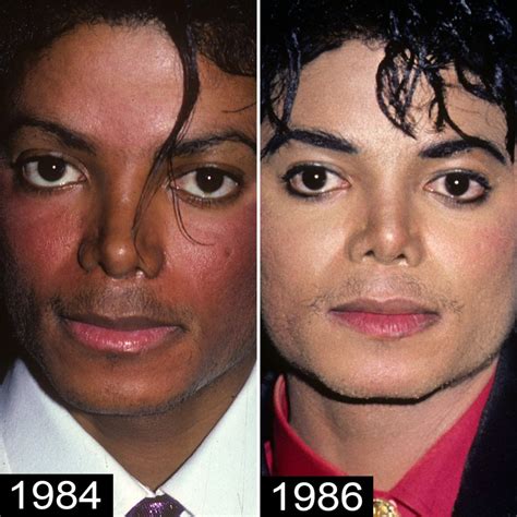 Michael Jacksons Plastic Surgery — See His Transformation