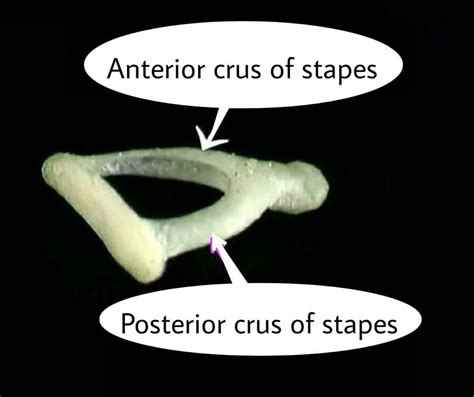 پایک قدامی استخوانچه رکابی اطلس الکترونیک آناتومی
