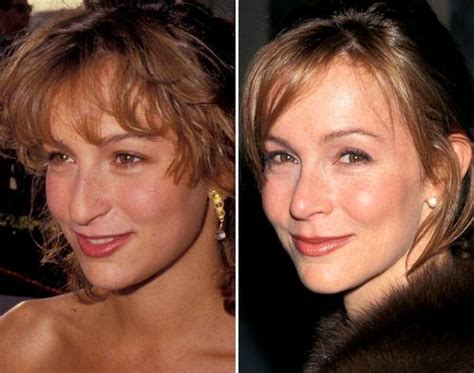 Top Jennifer Grey Before And After