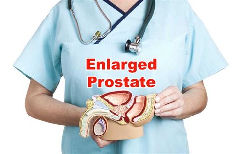 Prostate Enlargement Is A Common In Men Over Enlarged Prostate Prostate Men Over