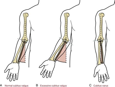 Structure And Function Of The Elbow And Forearm Complex Musculoskeletal Key