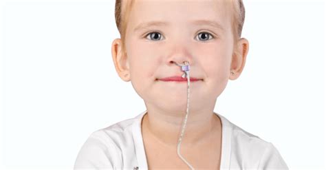 Stabilization Of Nasoenteric Feeding Tubes Using Nasal Bridles In