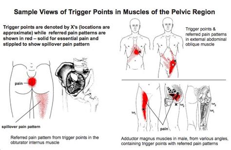 Pin On Workout Pain Management Back Knee Pelvic Hip Reflexors