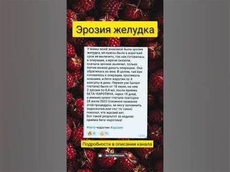Эрозия желудка #shortvideoviral - YouTube Картинка - Эрозия желудка #shortvideoviral - YouTube