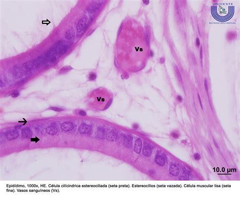 Pseudo Estratificado Cilíndrico Com Estereocílios Unioeste