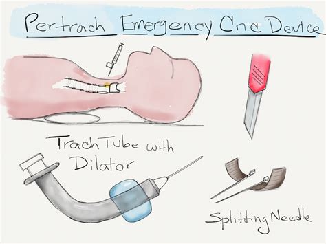 Pertrach Cricothyrotomy Resus Review
