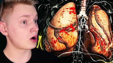 Najgorsza Choroba Na Świecie Bio Inc Redemption Youtube