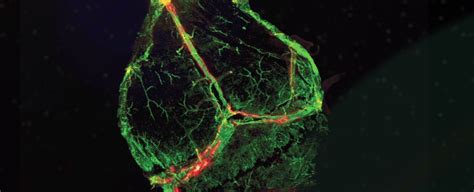 Stunning Scientists Discover The Missing Link — Lymphatic Vessels