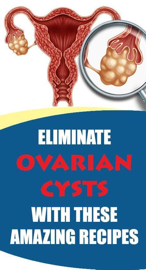 Eliminate Ovary Cysts With These Amazing Recipes Tracey Fraser Medium